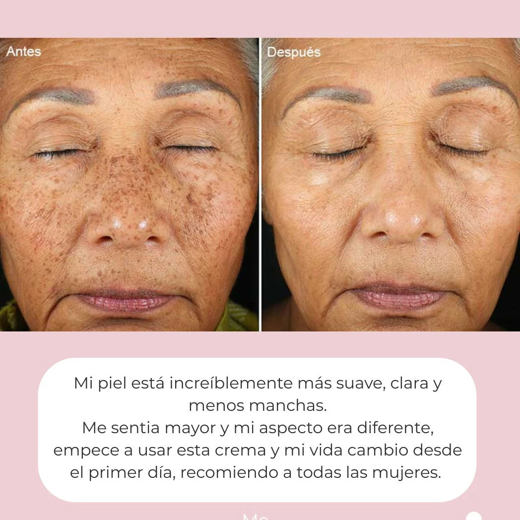 ¡10 Años Menos! Dragon’s Blood – Crema Rejuvenecedora Natural