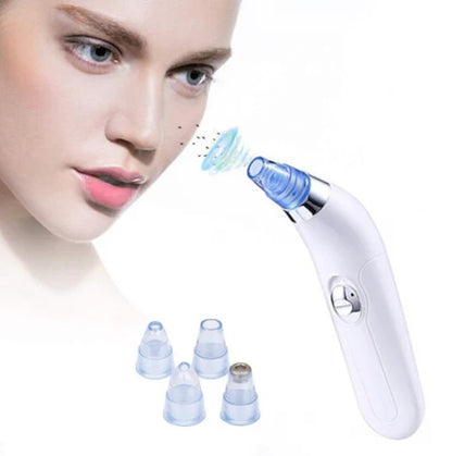 Limpiador de Poros Facial por Succión